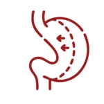 Bariatra evaluando composición corporal en obesidad